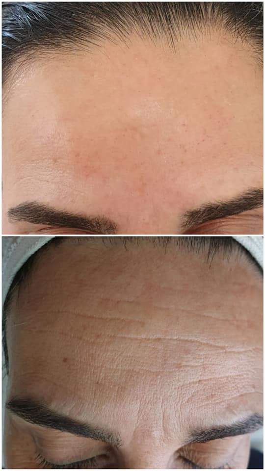 קוסמטיקאיות | סטודיו מרלין טיפוח ואסתטיקה