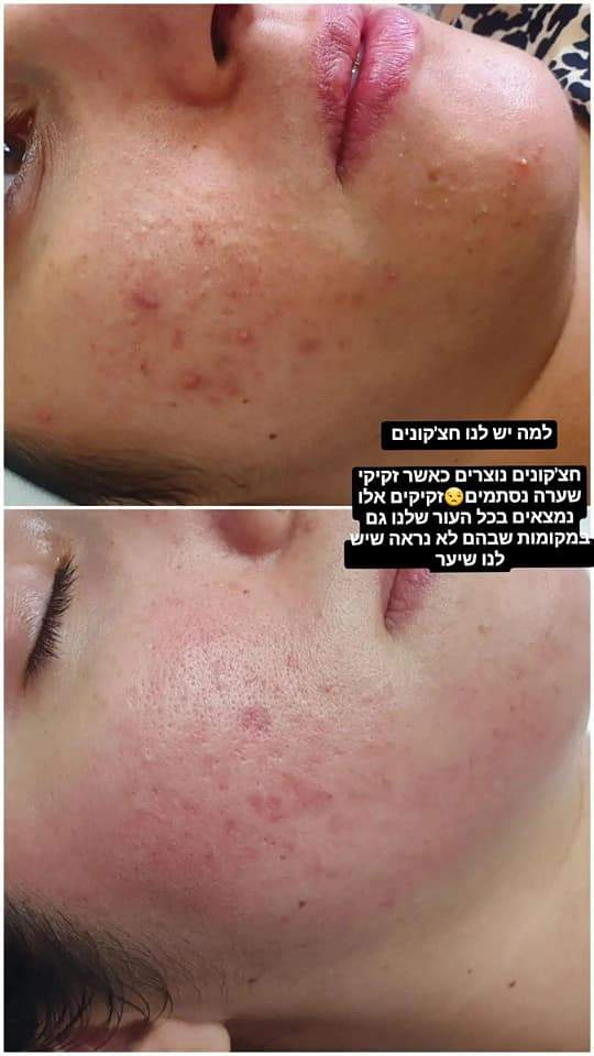 خبيرات تجميل | استوديو مارلين للعناية والتجميل